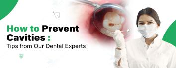 How to Prevent Cavities?