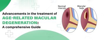  Macular Degeneration Treatment Hospitals