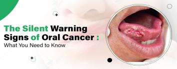 Warning Signs of Oral Cancer