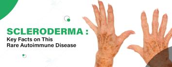 Scleroderma