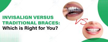 traditional braces