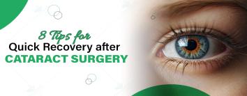 best Hospital for Cataract surgery