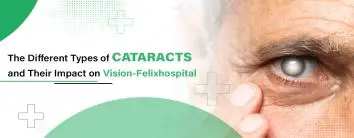 Best Cataract Surgery Hospital in Noida