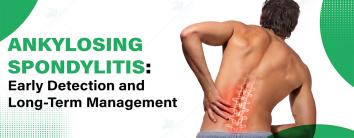 Ankylosing Spondylitis: Early Detection and Long-Term Management