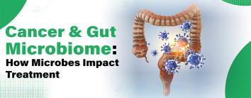 Cancer & Gut Microbiome: How Microbes Impact Treatment