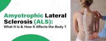 Amyotrophic Lateral Sclerosis