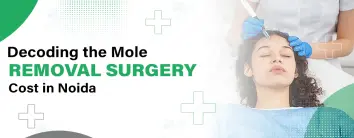 Best Hospital for mole Treatment in Noida
