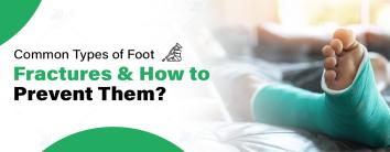 Types of Foot Fractures