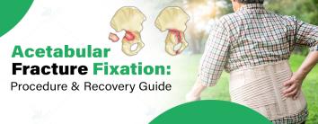 Acetabular Fracture Fixation