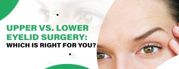 Upper-vs-lower-eyelid-surgery