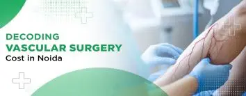 Decoding the Cost of Vascular Surgery in Noida
