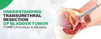 Best Hospital For Bladder Tumor (TURBT)