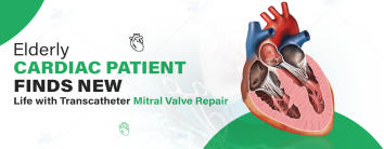 Transcatheter Mitral Valve Repair (TMVR)