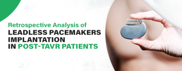 Best Pacemaker Treatments Hospital in Noida