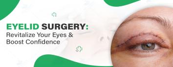 Eyelid surgery