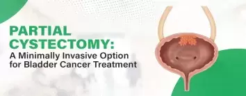 best hospital for Partial cystectomy Bladder cancer treatment Surgery in Noida