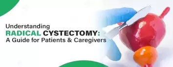 best hospital for radical cystectomy treatment Surgery 