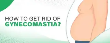 gynecomastia