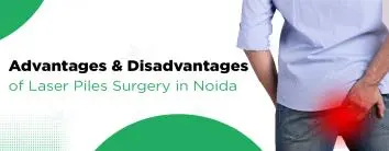 Advantages and Disadvantages of Laser Piles Surgery in Noida