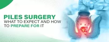 Piles Surgery - What to Expect and How to Prepare for It
