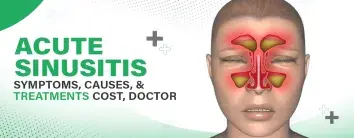 Acute Sinusitis: Symptoms, Causes, Treatments, Cost, and Doctor