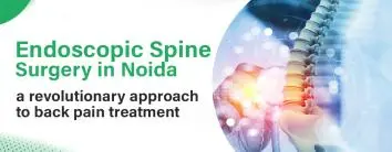 Endoscopic Spine Surgery in Noida