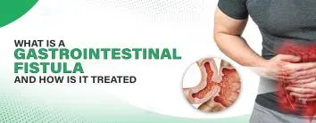 Gastrointestinal Fistula