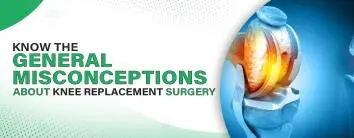 Know the General Misconceptions about Knee Replacement Surgery