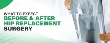 Looking for the best hip replacement surgery in Noida