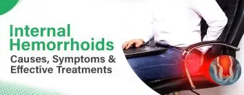 Internal Hemorrhoids