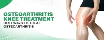 Osteoarthritis Knee Treatment