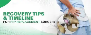 Recovery Tips and Timeline for Hip Replacement Surgery