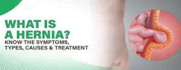 What is a Hernia