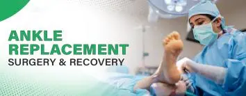 ankle-replacement