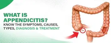 What is Appendicitis