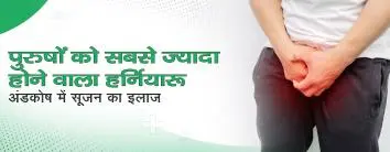 पुरुषों को सबसे ज्यादा होने वाला हर्निया: अंडकोष में सूजन का इलाज