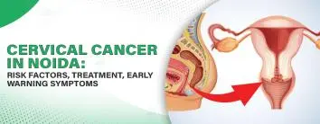 Cervical Cancer in Noida: Risk Factors, Treatment, Early Warning Symptoms