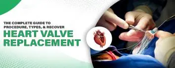 Heart Valve Replacement: The Complete Guide to Procedure, Types, and Recovery