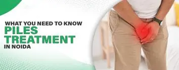 Piles Treatment in Noida