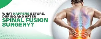 What Happens Before, During, and After Spinal Fusion Surgery?