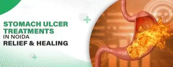 Stomach Ulcer Treatments In Noida: Relief and Healing