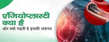 एंजियोप्लास्टी क्या है और क्यों पड़ती है इसकी जरूरत? (कार्डियोलॉजी)