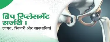 हिप रिप्लेसमेंट सर्जरी: लागत, रिकवरी और सावधानियां