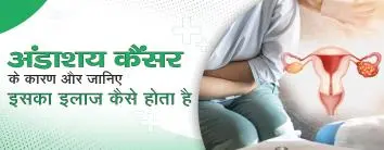अंडाशय कैंसर