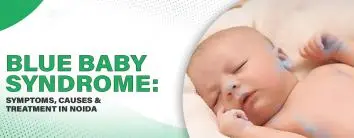 Blue Baby Syndrome: Symptoms, Causes & Treatment in Noida