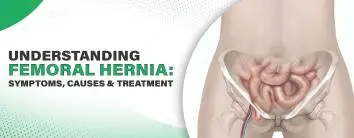 Femoral Hernia