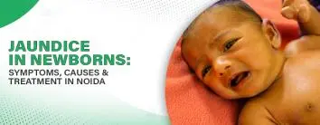 Jaundice in Newborns: Symptoms, Causes & Treatment in Noida