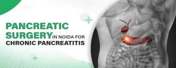 Pancreatic Surgery in Noida for Chronic Pancreatitis