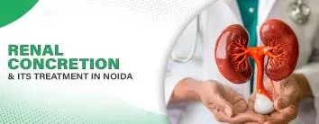 Renal Concretion and its Treatment In Noida