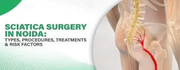 Sciatica Surgery in Noida: Procedures, Types, Treatments & Risk Factors